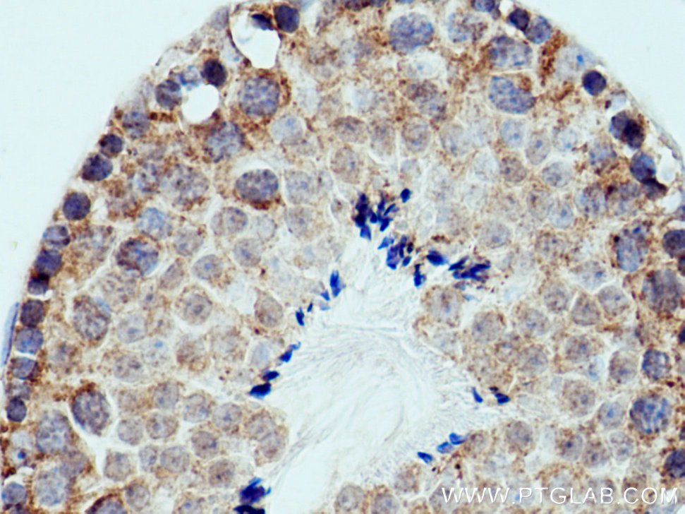 IHC staining of mouse testis using 12875-1-AP (same clone as 12875-1-PBS)