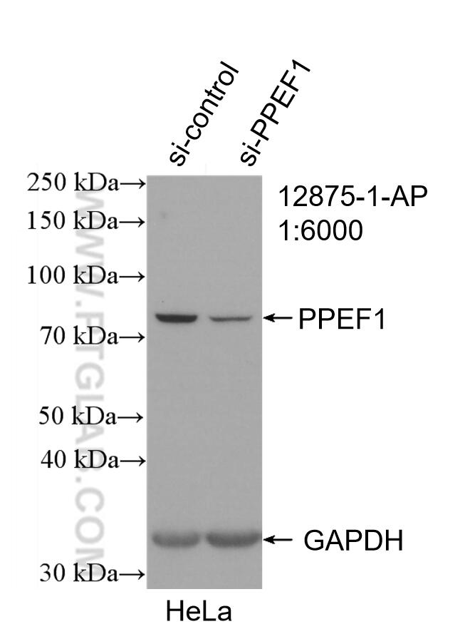 WB analysis of HeLa using 12875-1-AP (same clone as 12875-1-PBS)