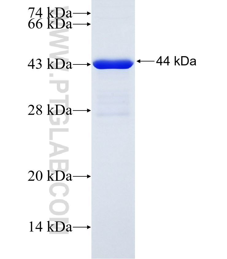 PPEF1 fusion protein Ag28279 SDS-PAGE PPEF1 fusion protein Ag28279 SDS-PAGE