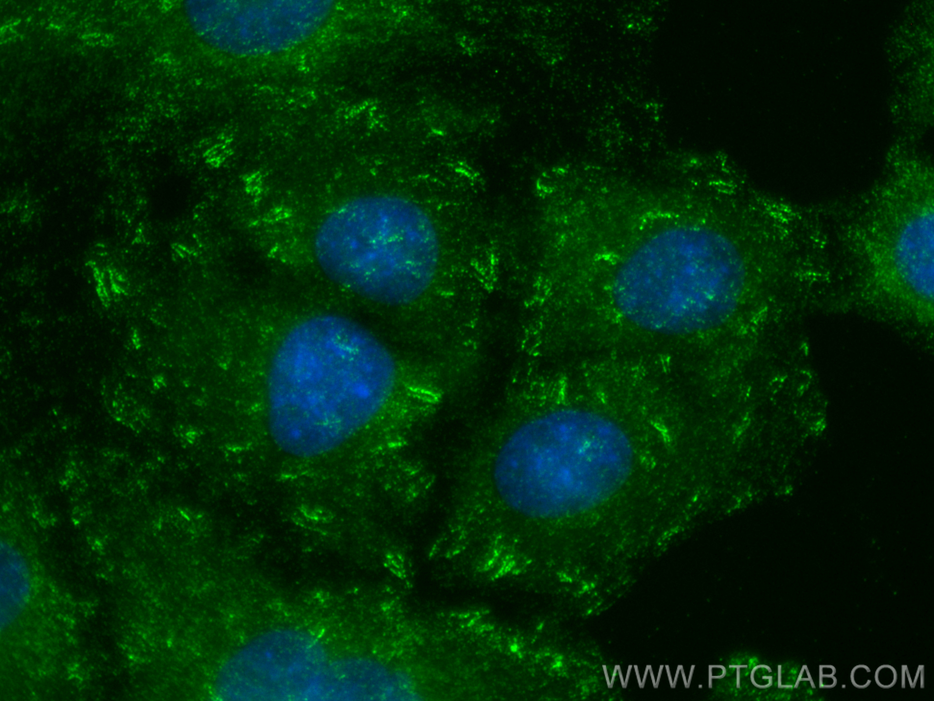 IF Staining of A549 using 14175-1-AP