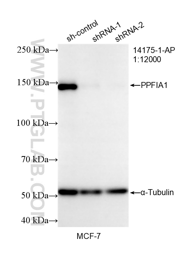 WB result of Liprin Alpha 1 antibody (14175-1-AP; 1:12000; incubated at room temperature for 1.5 hours) with sh-Control and sh-Liprin Alpha 1 transfected MCF-7 cells. WB analysis of MCF-7 using 14175-1-AP
