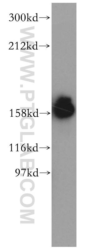 WB analysis of HeLa using 14175-1-AP