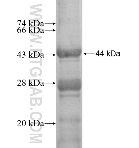 PPFIA2 fusion protein Ag12989 SDS-PAGE