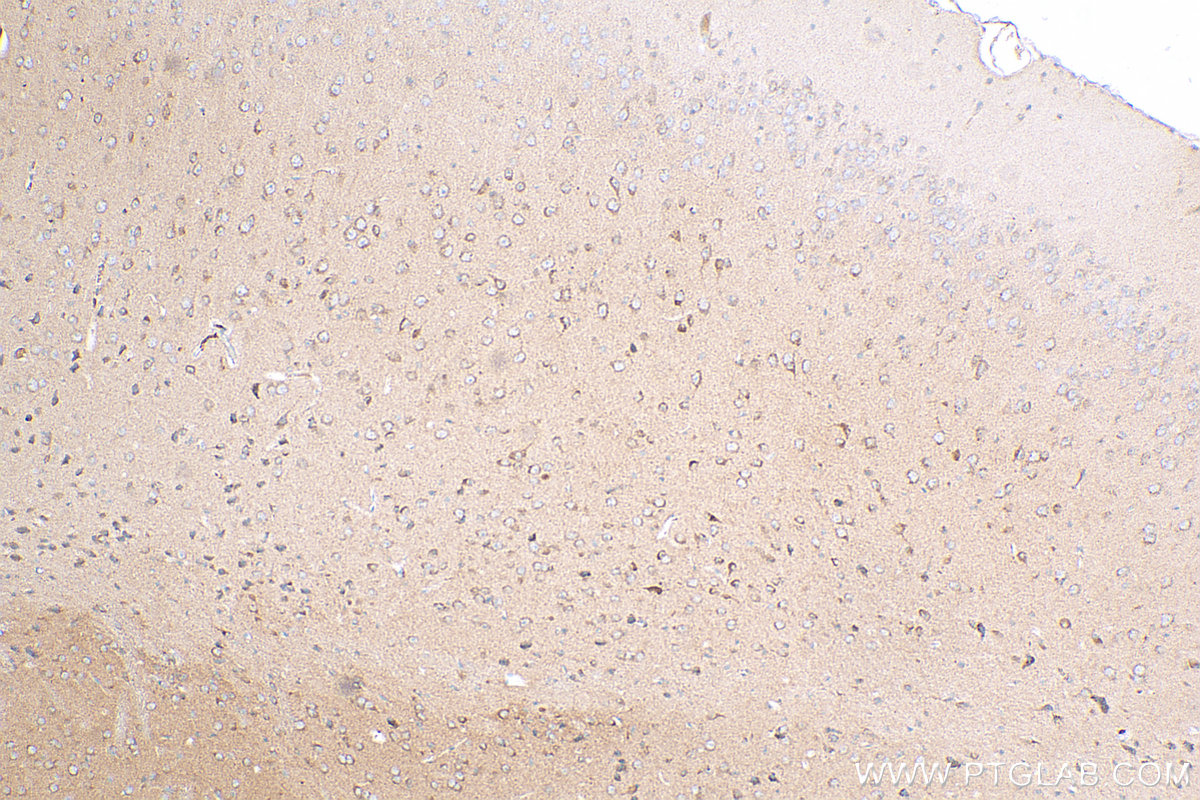 IHC staining of mouse brain using 25295-1-AP