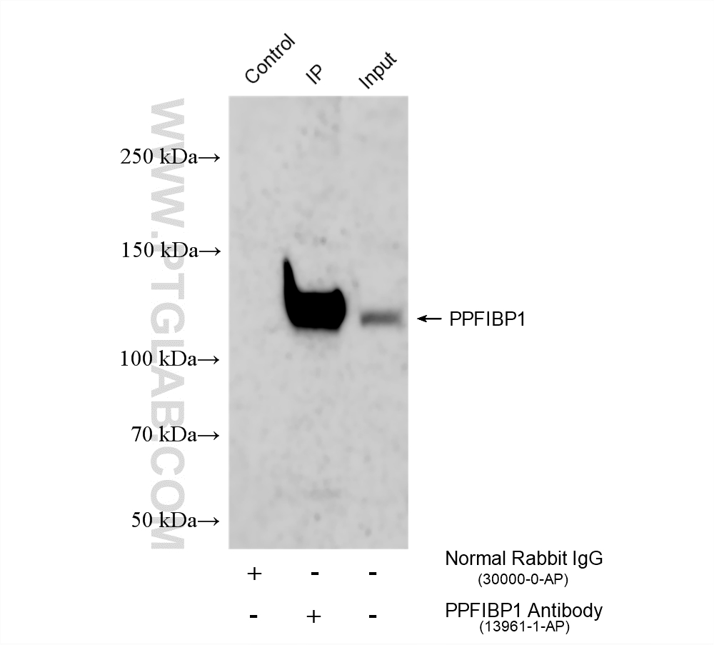 IP experiment of Neuro-2a using 13961-1-AP IP experiment of Neuro-2a using 13961-1-AP