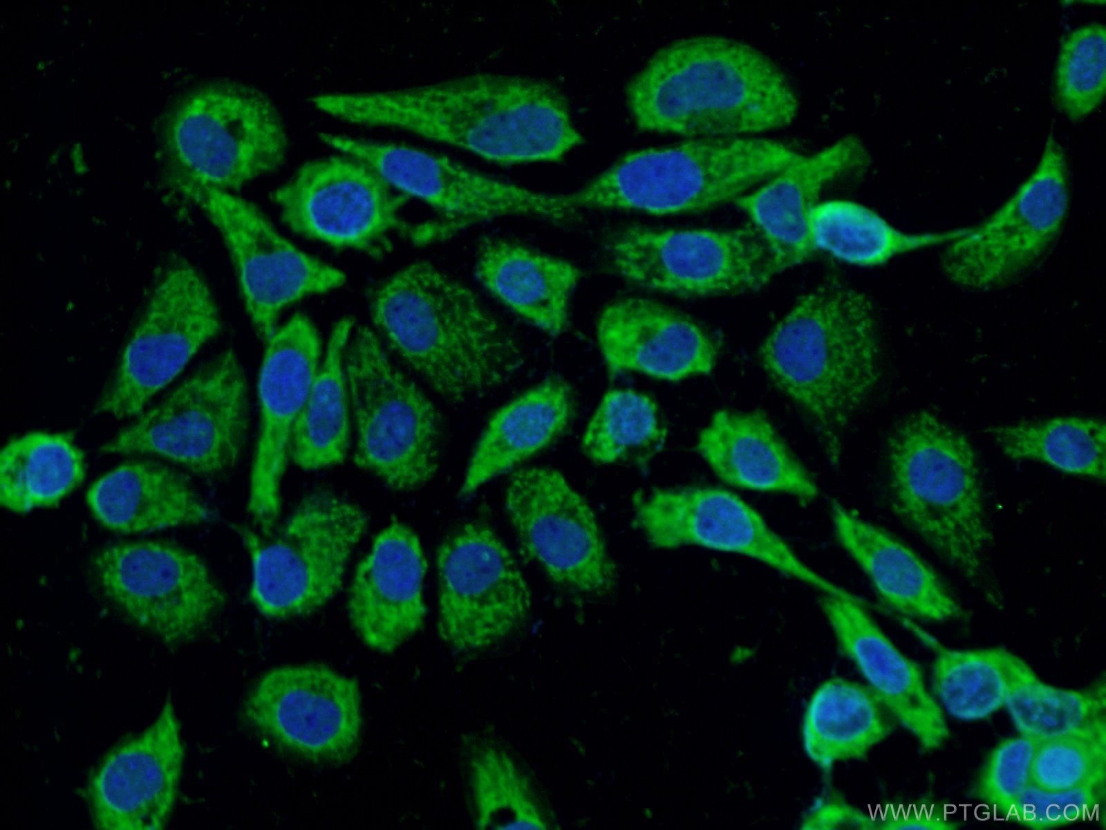 PPFIBP2 Polyclonal antibody