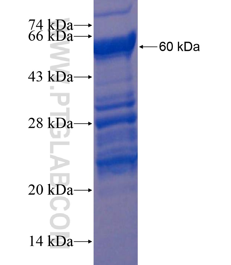 PPHLN1 fusion protein Ag18029 SDS-PAGE PPHLN1 fusion protein Ag18029 SDS-PAGE