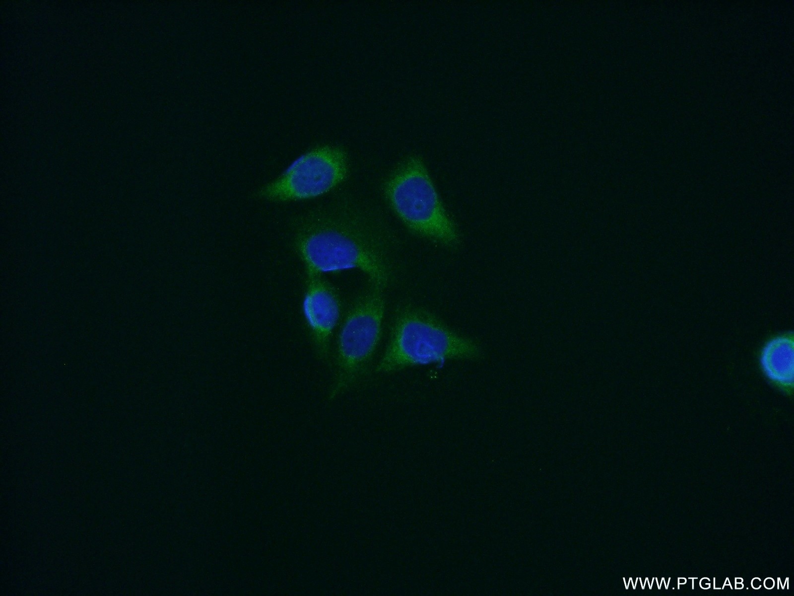 IF Staining of HeLa using 11607-1-AP