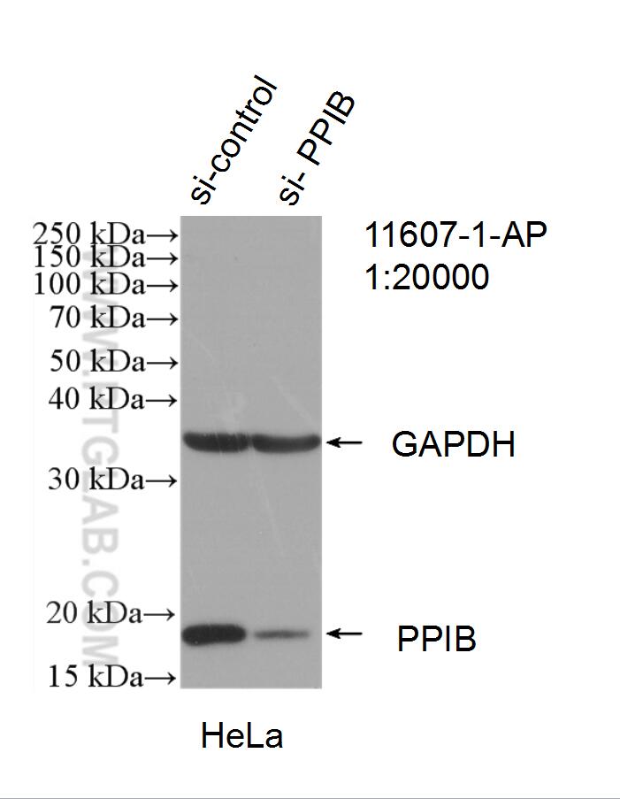 WB analysis of HeLa using 11607-1-AP