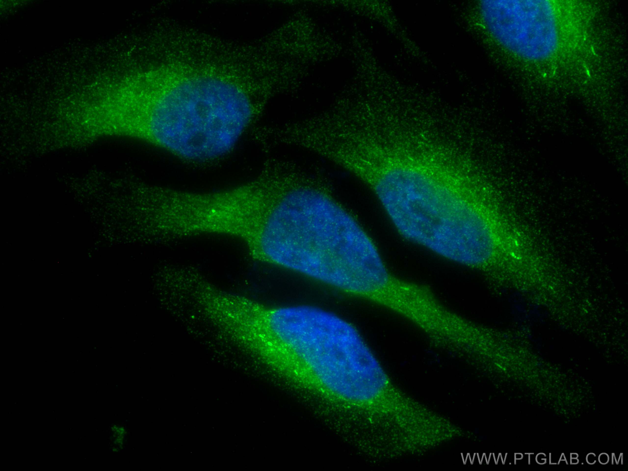 IF Staining of HeLa using 66047-1-Ig (same clone as 66047-1-PBS)