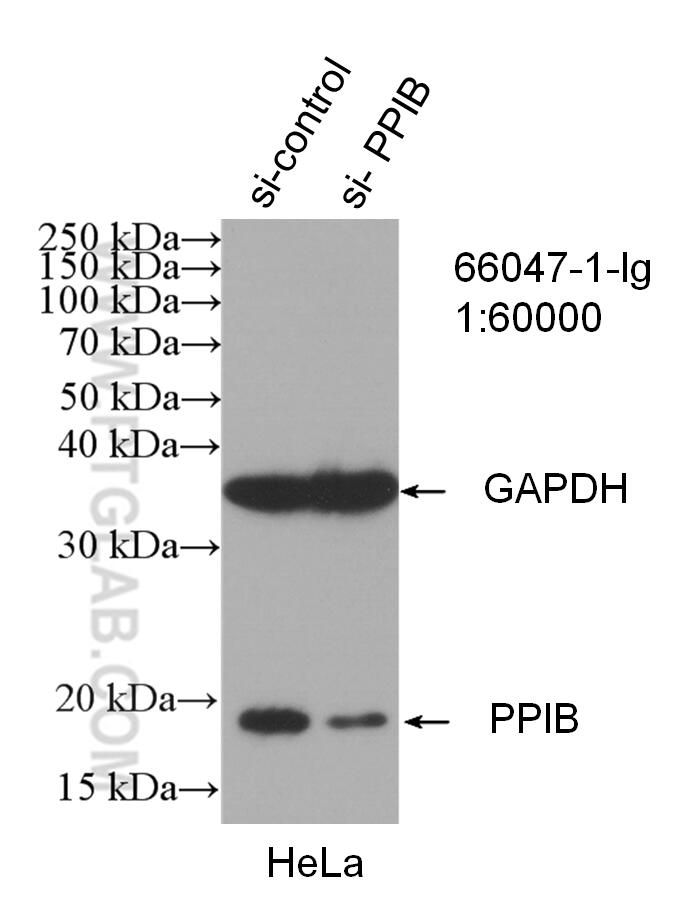 WB analysis of HeLa using 66047-1-Ig (same clone as 66047-1-PBS)