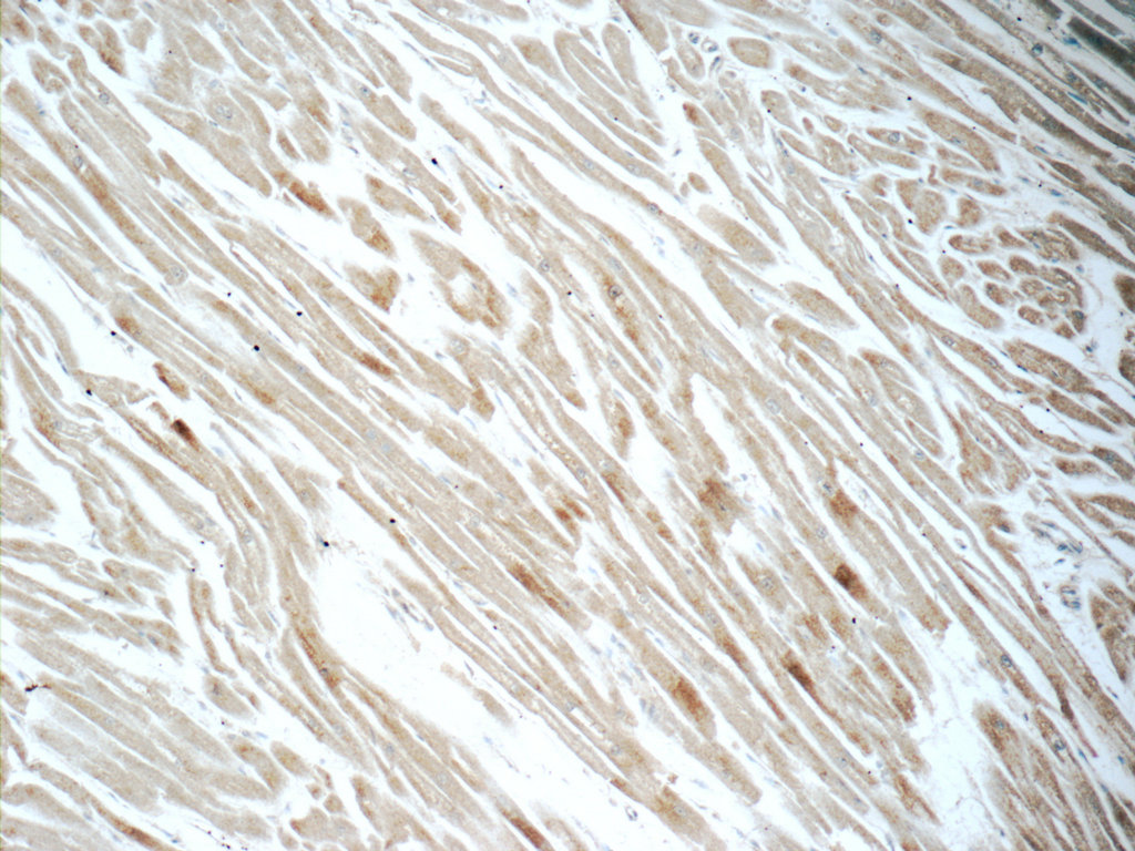 IHC staining of human heart using 10287-2-AP