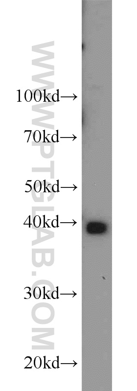 WB analysis of mouse brain using 12716-1-AP