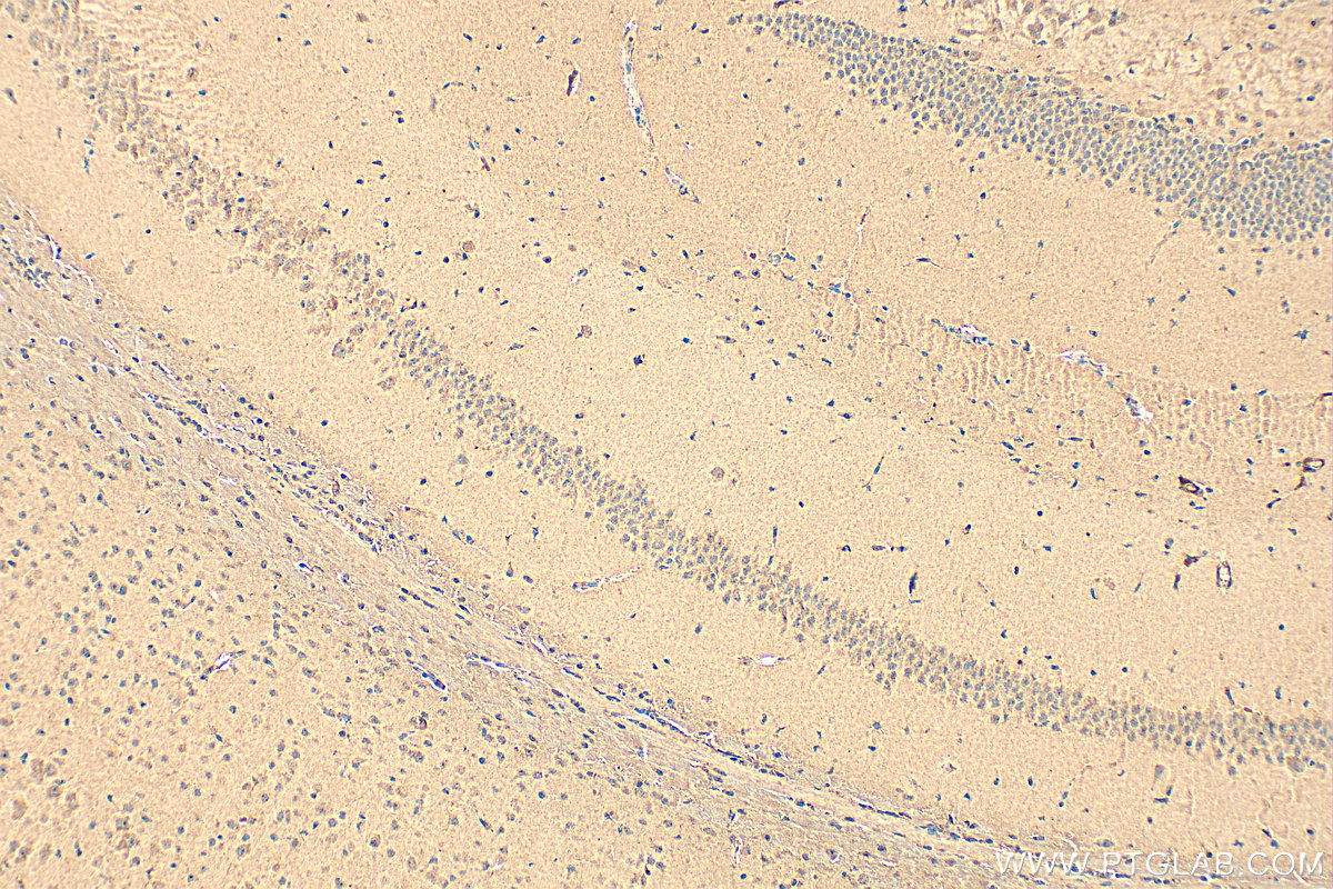 IHC staining of mouse brain using 15357-1-AP