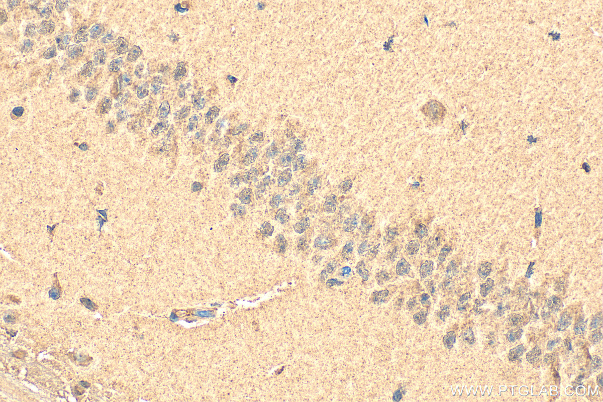 IHC staining of mouse brain using 15357-1-AP