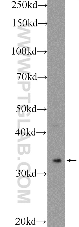 WB analysis of HEK-293 using 15357-1-AP