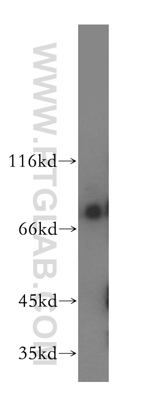 WB analysis of human liver using 12985-1-AP