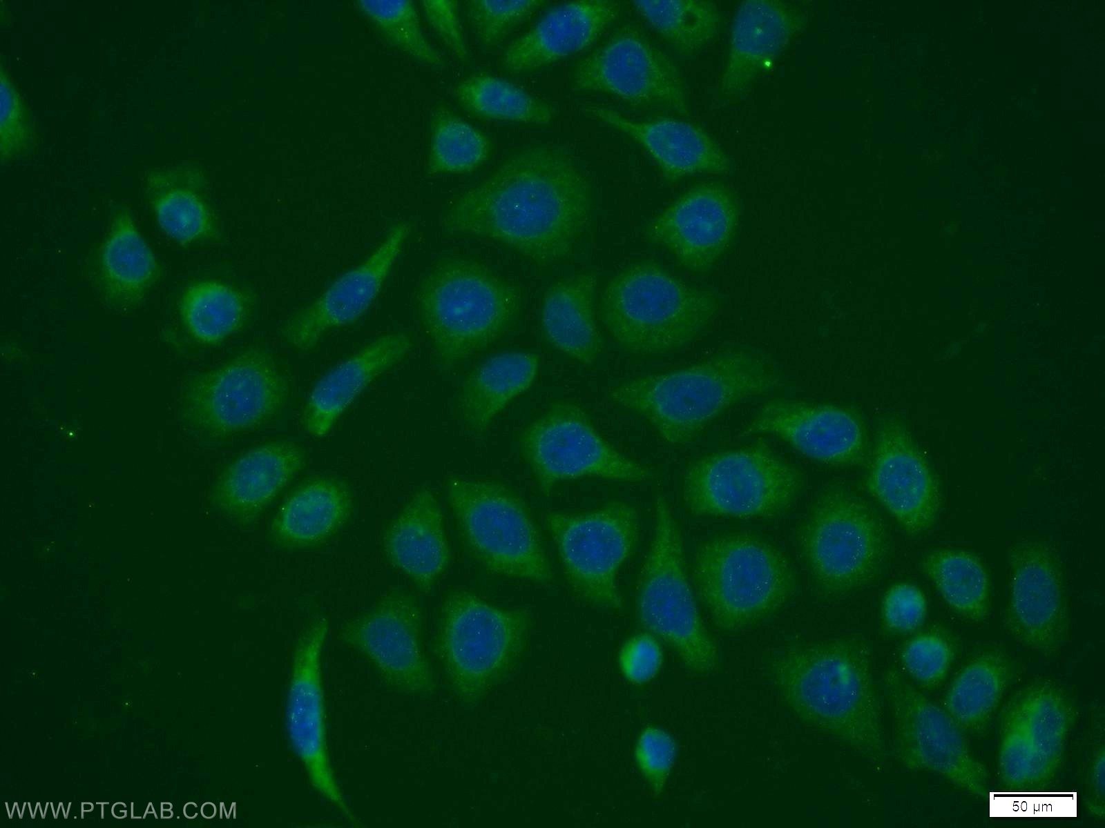 IF Staining of PC-3 using 11651-1-AP