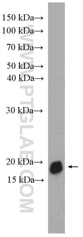 WB analysis of U2OS using 11651-1-AP