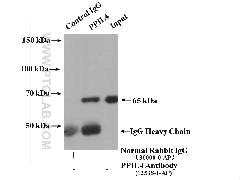 IP experiment of HeLa using 12538-1-AP