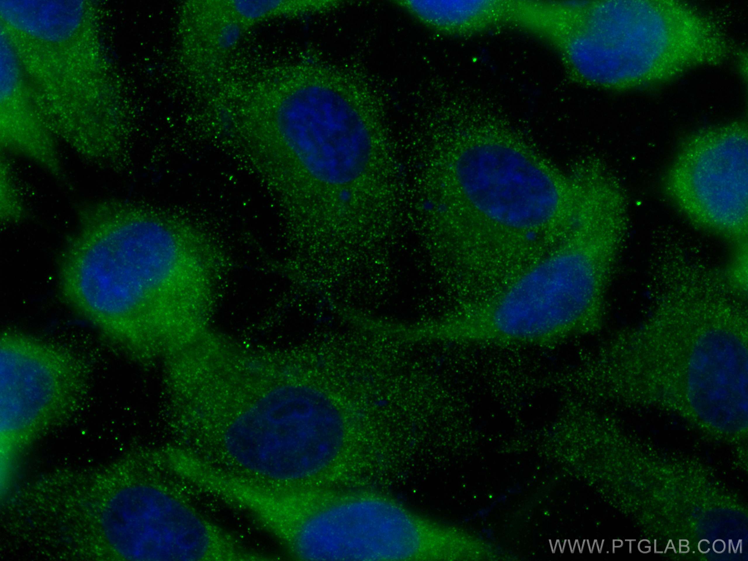 IF Staining of A431 using 67647-1-Ig