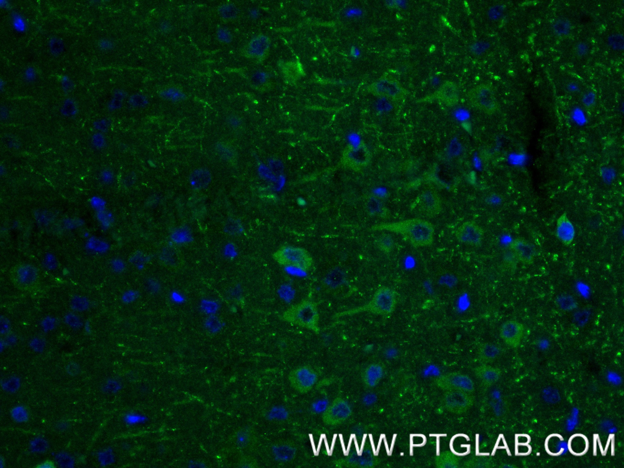 IF Staining of mouse brain using 87405-1-RR (same clone as 87405-1-PBS)