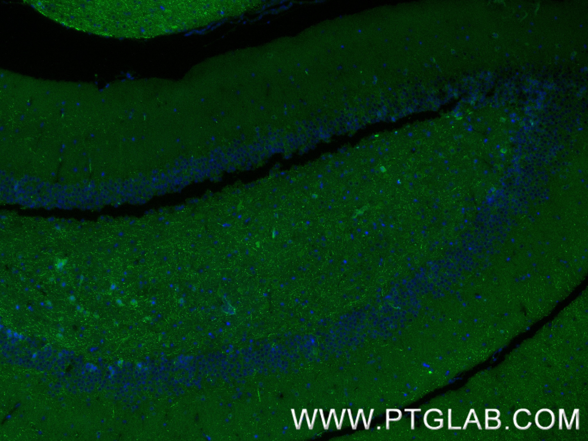 IF Staining of mouse brain using 87405-1-RR (same clone as 87405-1-PBS)