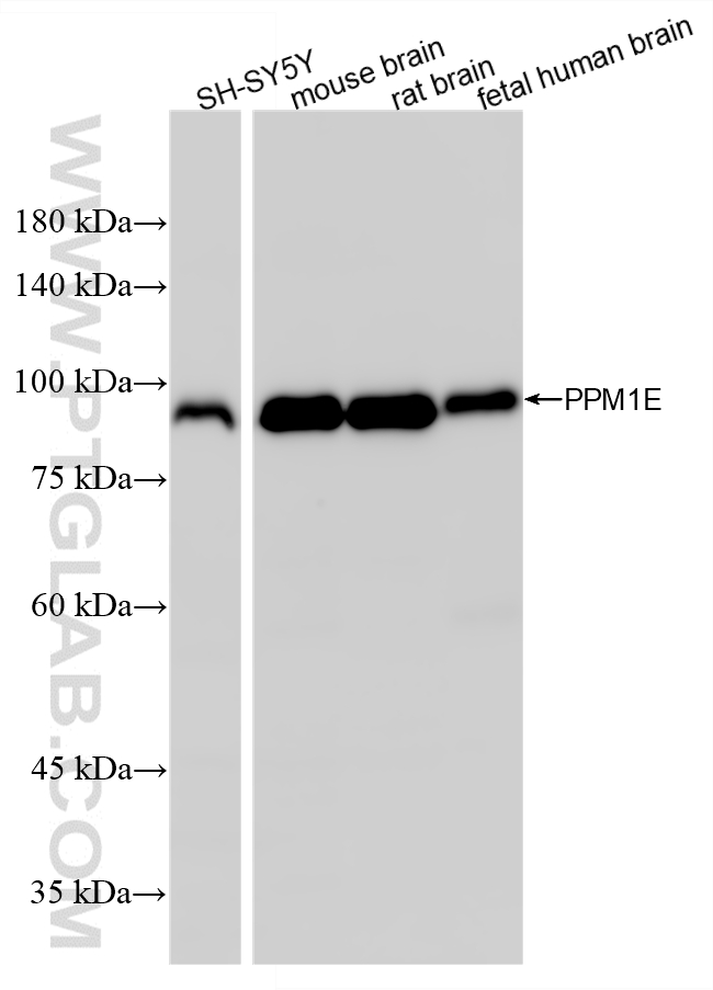 WB analysis using 87405-1-RR (same clone as 87405-1-PBS)