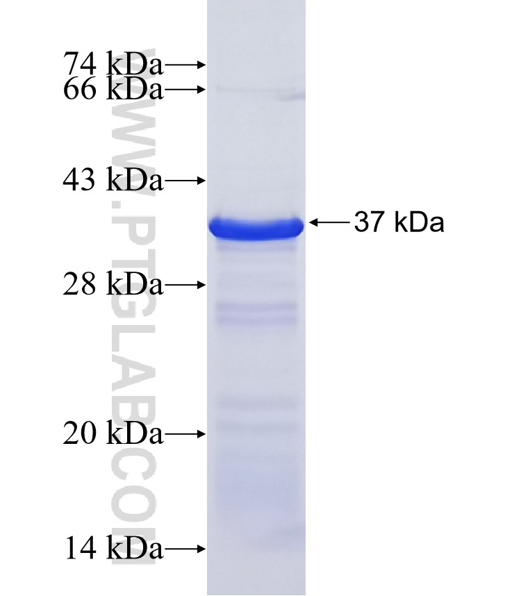 PPM1E fusion protein Ag18903 SDS-PAGE