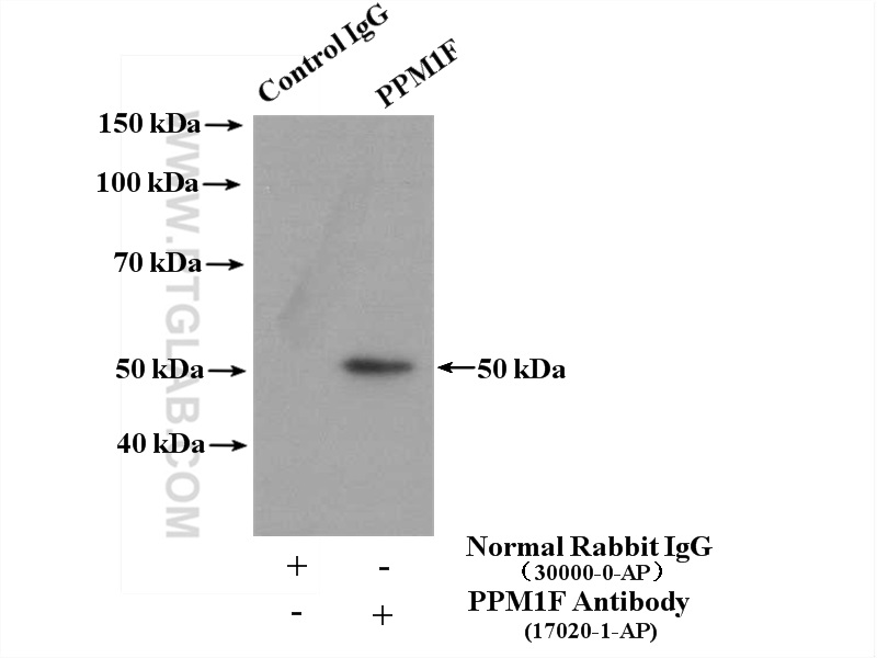 IP experiment of MCF-7 using 17020-1-AP