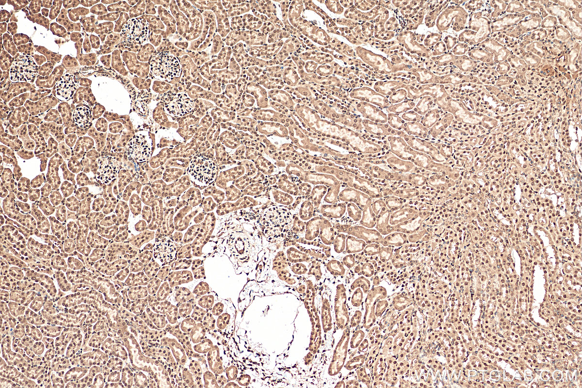 IHC staining of mouse kidney using 15532-1-AP (same clone as 15532-1-PBS)
