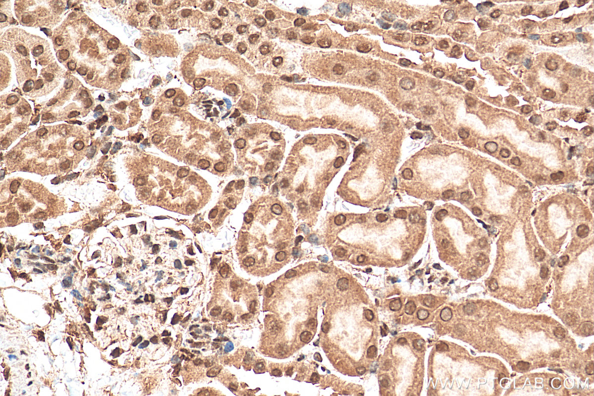 IHC staining of mouse kidney using 15532-1-AP (same clone as 15532-1-PBS)