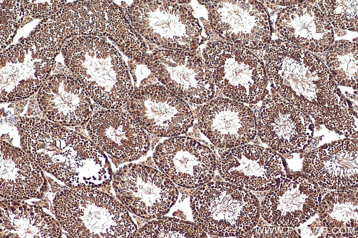 IHC staining of mouse testis using 15532-1-AP (same clone as 15532-1-PBS)