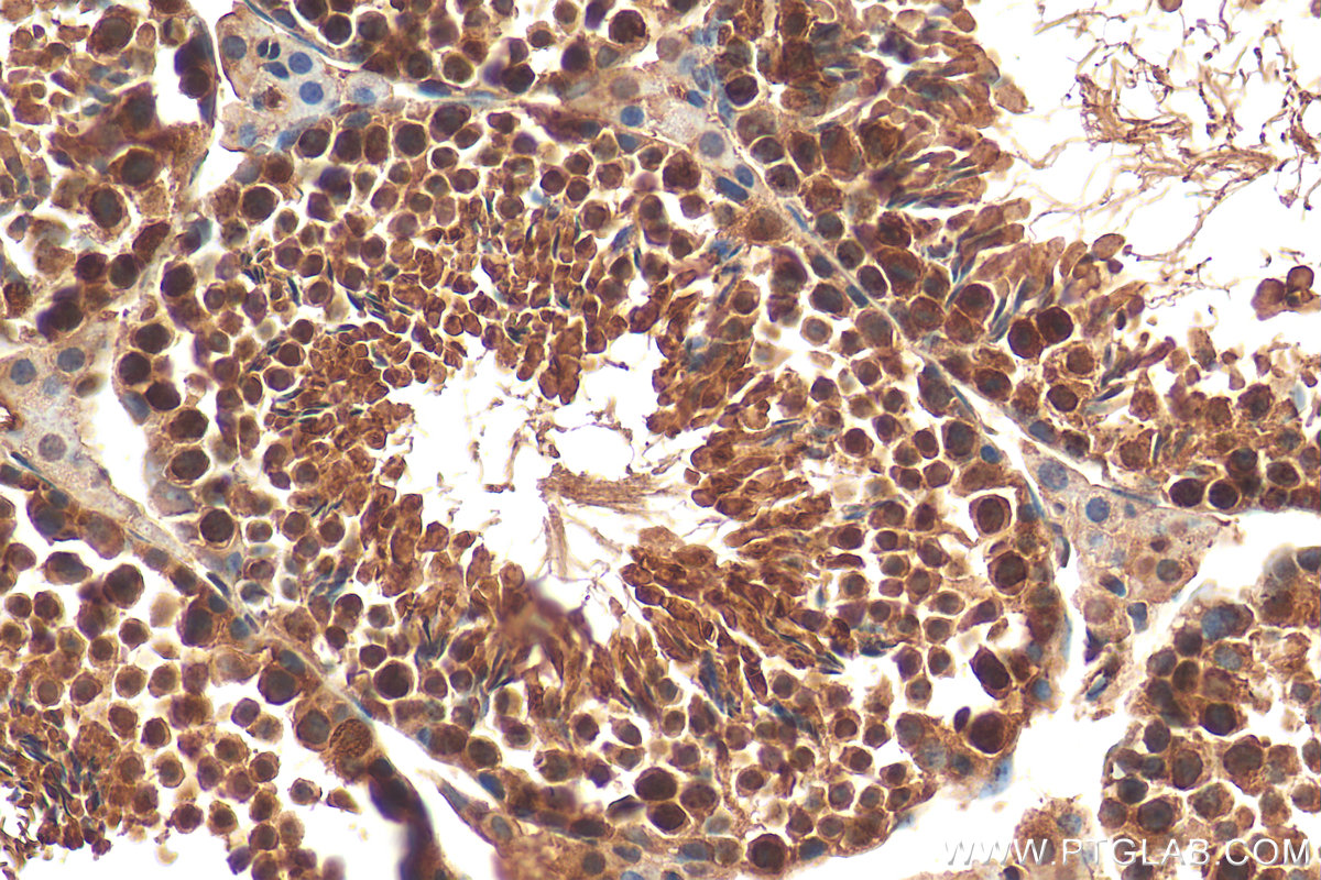 IHC staining of mouse testis using 15532-1-AP (same clone as 15532-1-PBS)