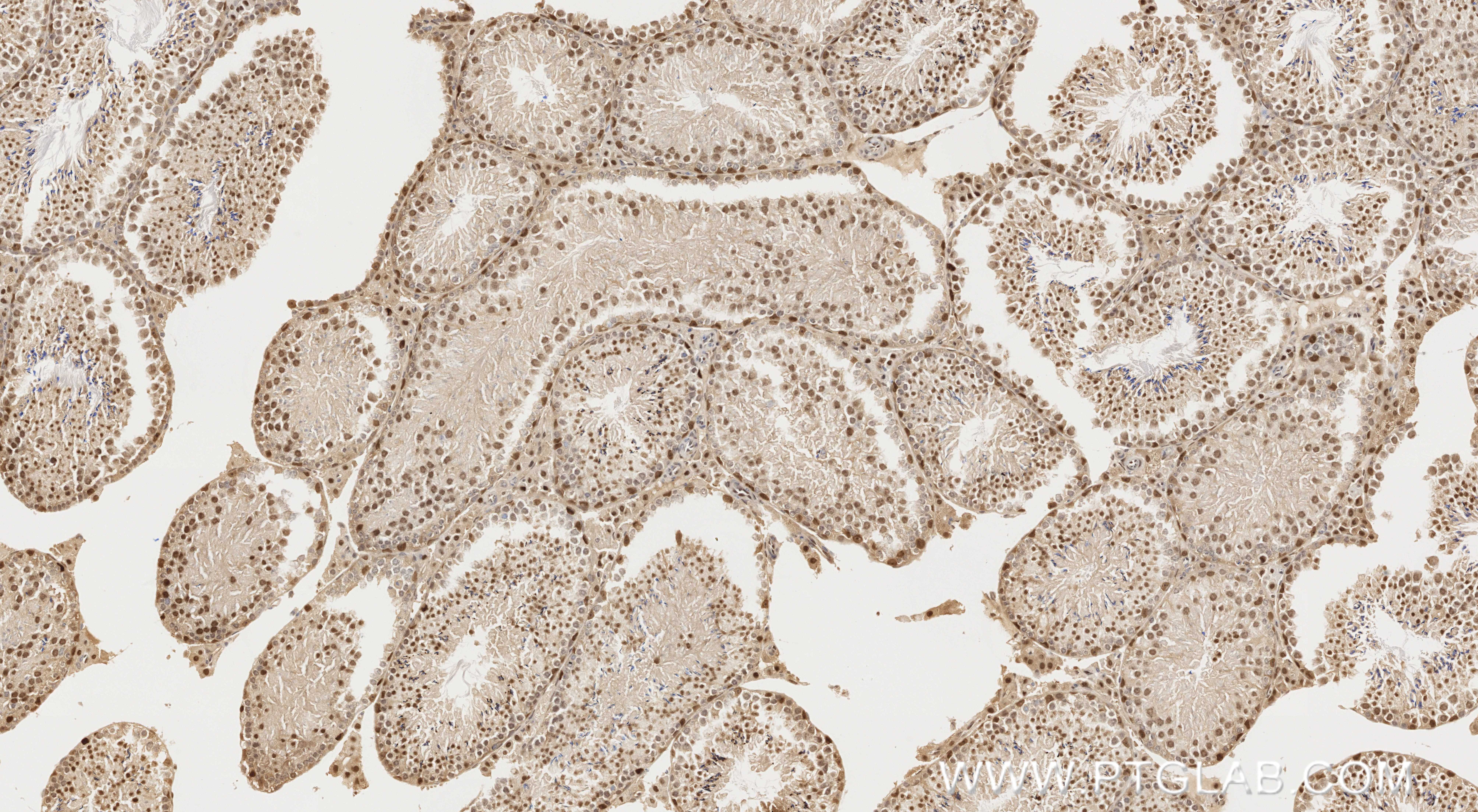 IHC staining of mouse testis using 87250-3-RR (same clone as 87250-3-PBS)
