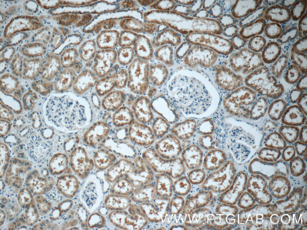 IHC staining of human kidney using 18203-1-AP