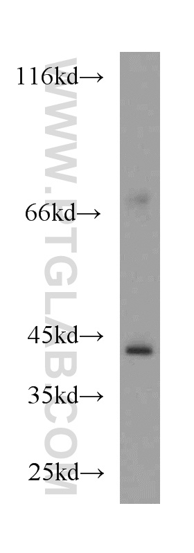 WB analysis of mouse kidney using 18203-1-AP