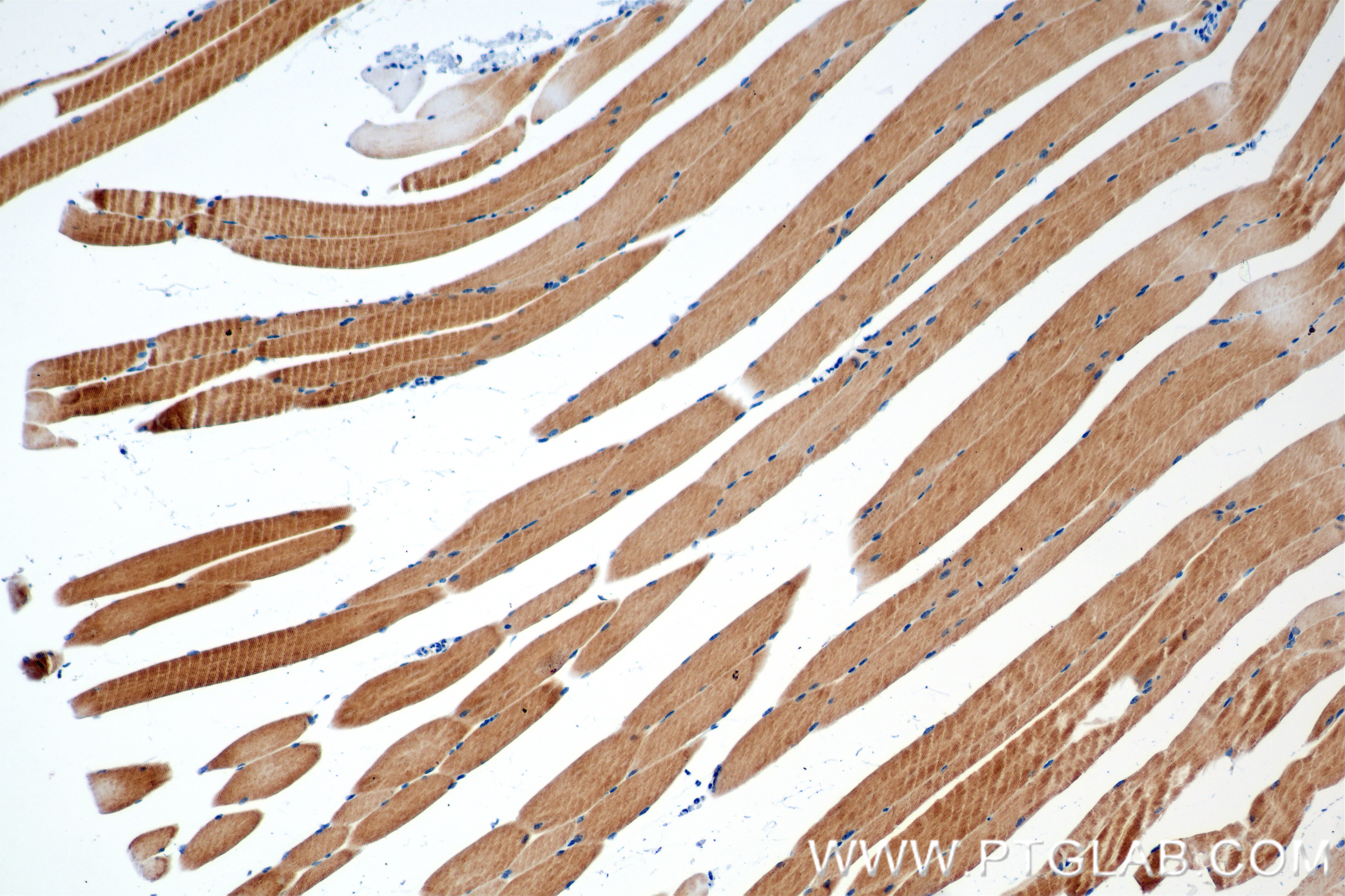 IHC staining of mouse skeletal muscle using 84612-3-RR