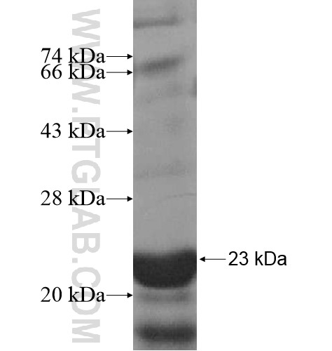 PPM2C fusion protein Ag15550 SDS-PAGE PPM2C fusion protein Ag15550 SDS-PAGE