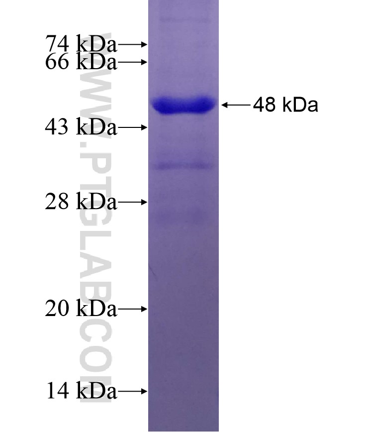 PPME1 fusion protein Ag5869 SDS-PAGE PPME1 fusion protein Ag5869 SDS-PAGE