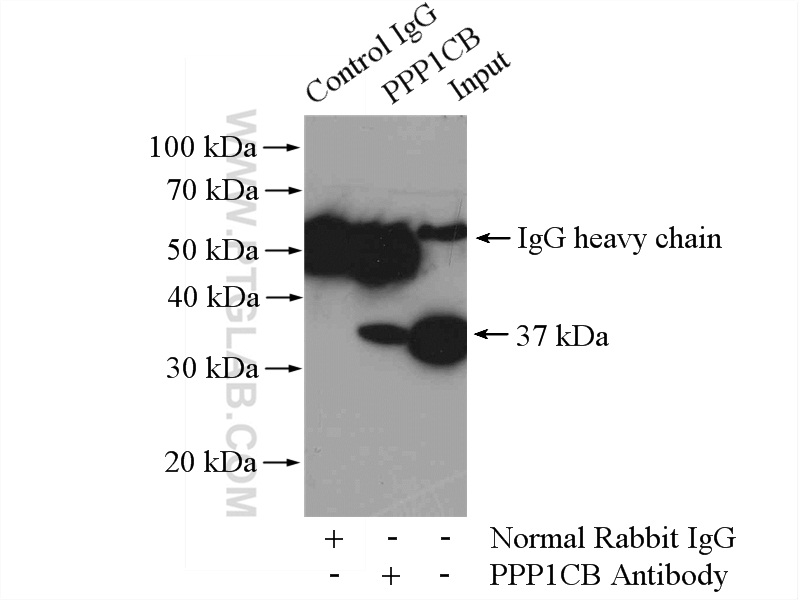 IP experiment of mouse brain using 10140-2-AP