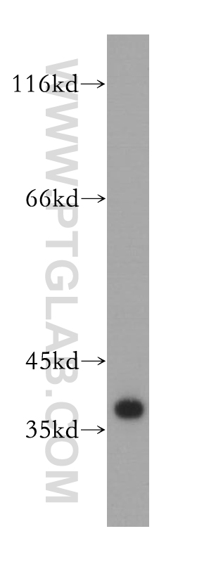 WB analysis of human brain using 10140-2-AP