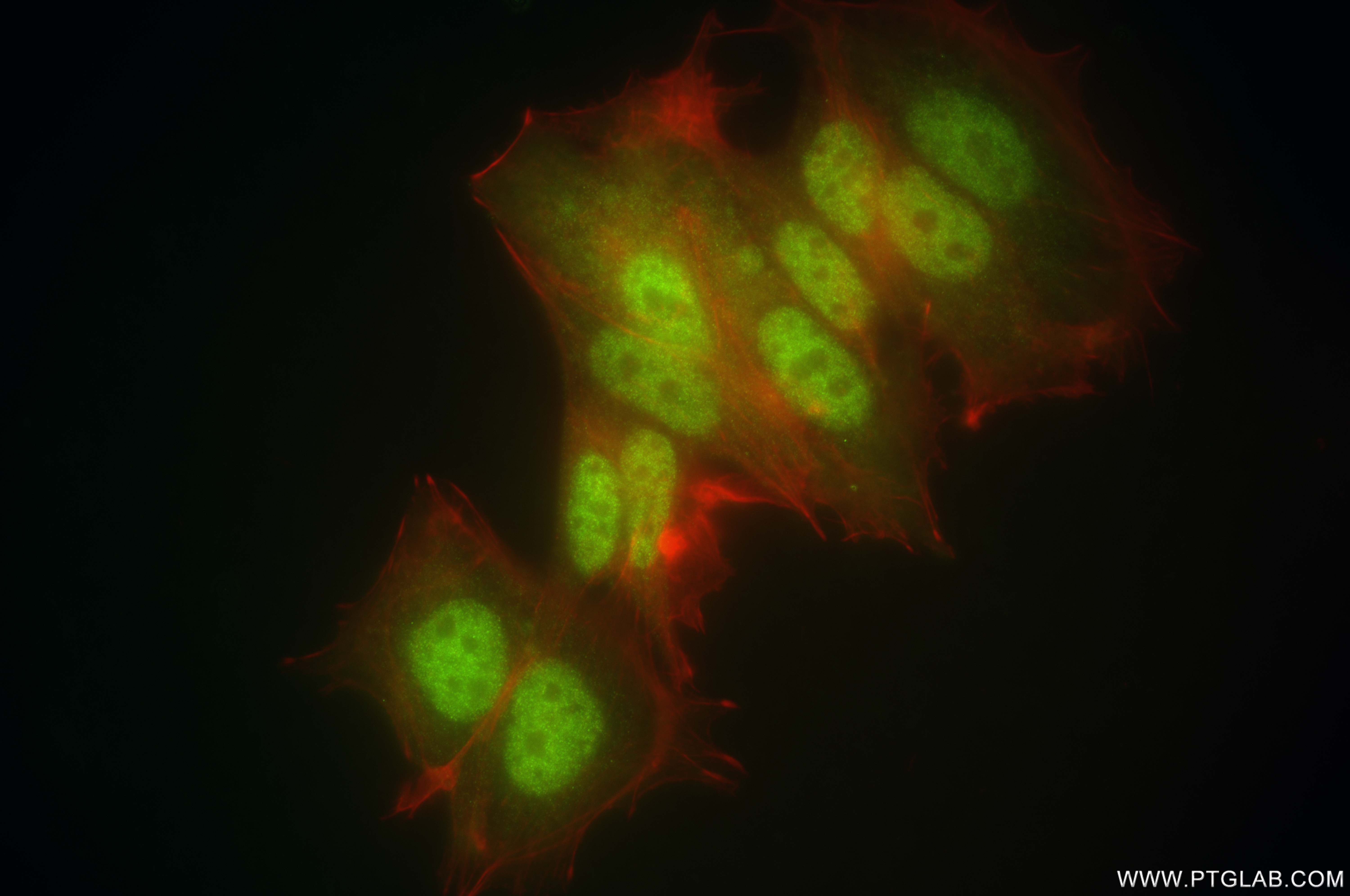 IF Staining of MCF-7 using 84938-5-RR