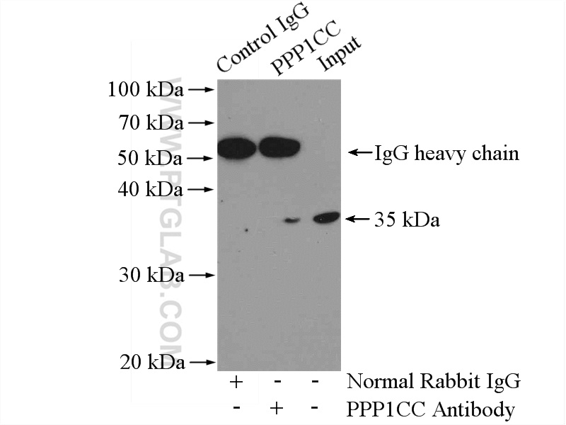 IP experiment of HEK-293 using 11082-1-AP