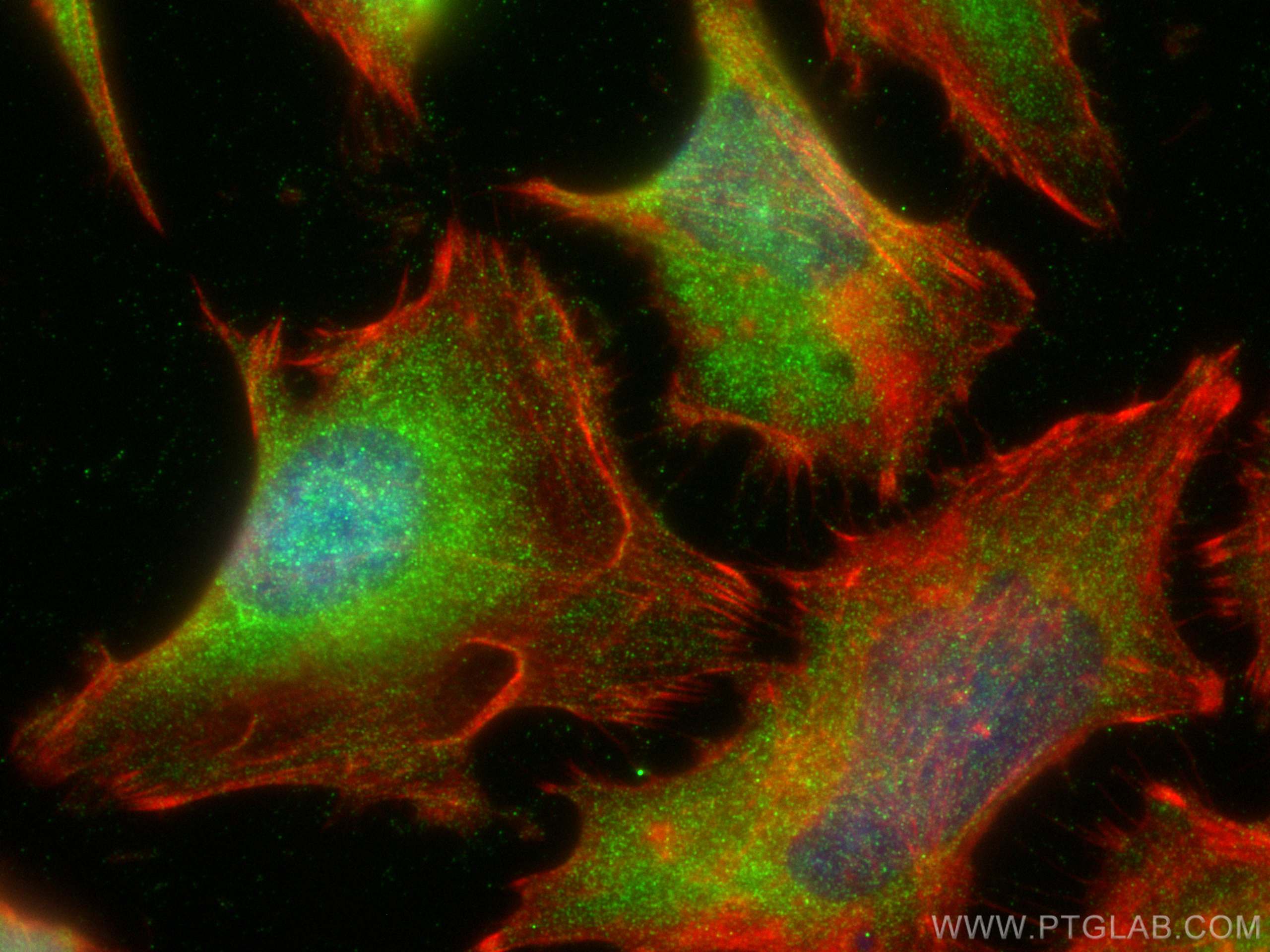 IF Staining of HeLa using 30070-1-AP