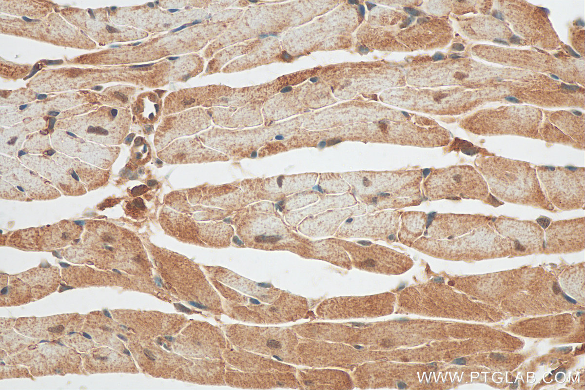 IHC staining of mouse heart using 30070-1-AP