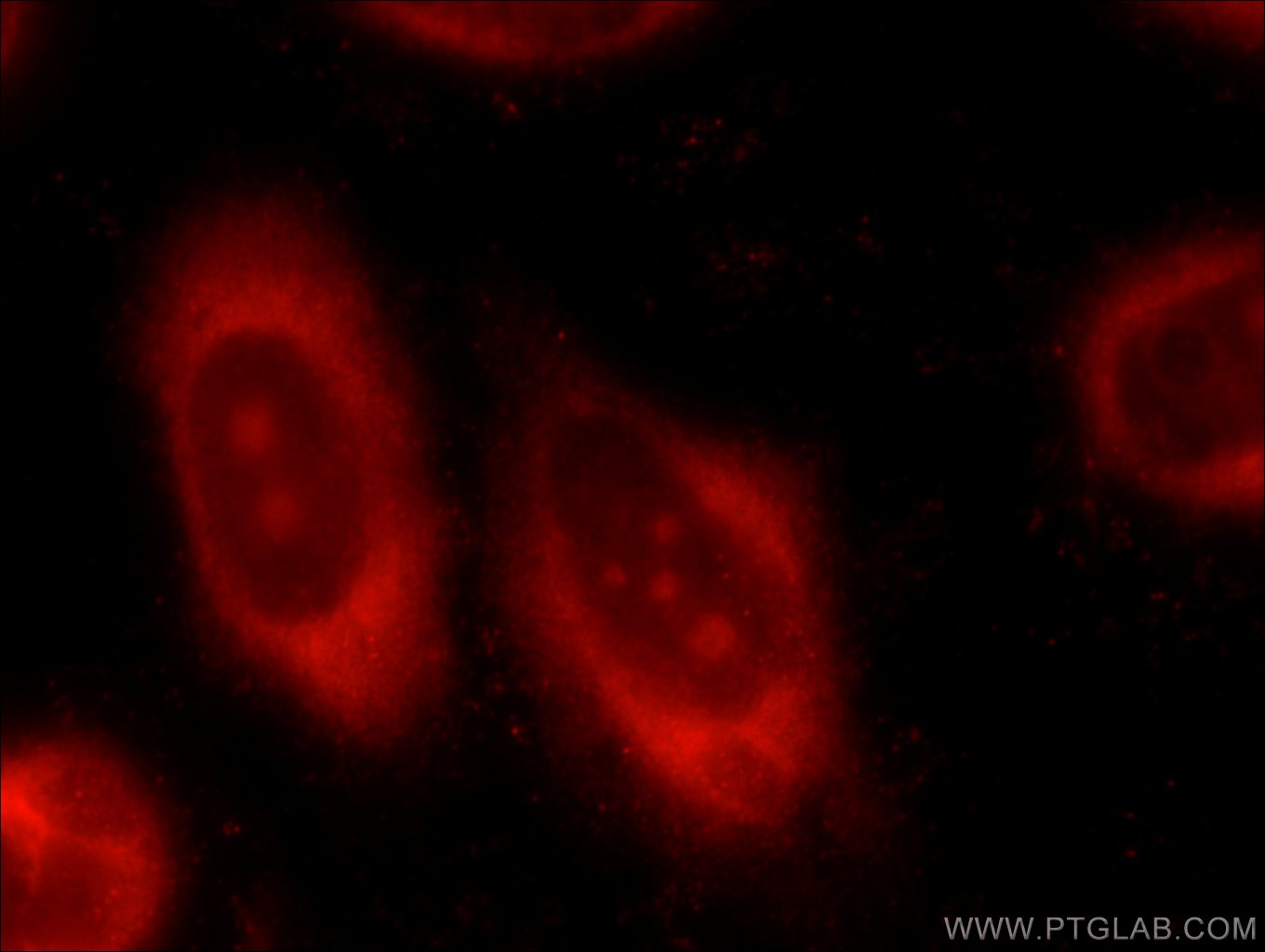 IF Staining of HeLa using 55150-1-AP