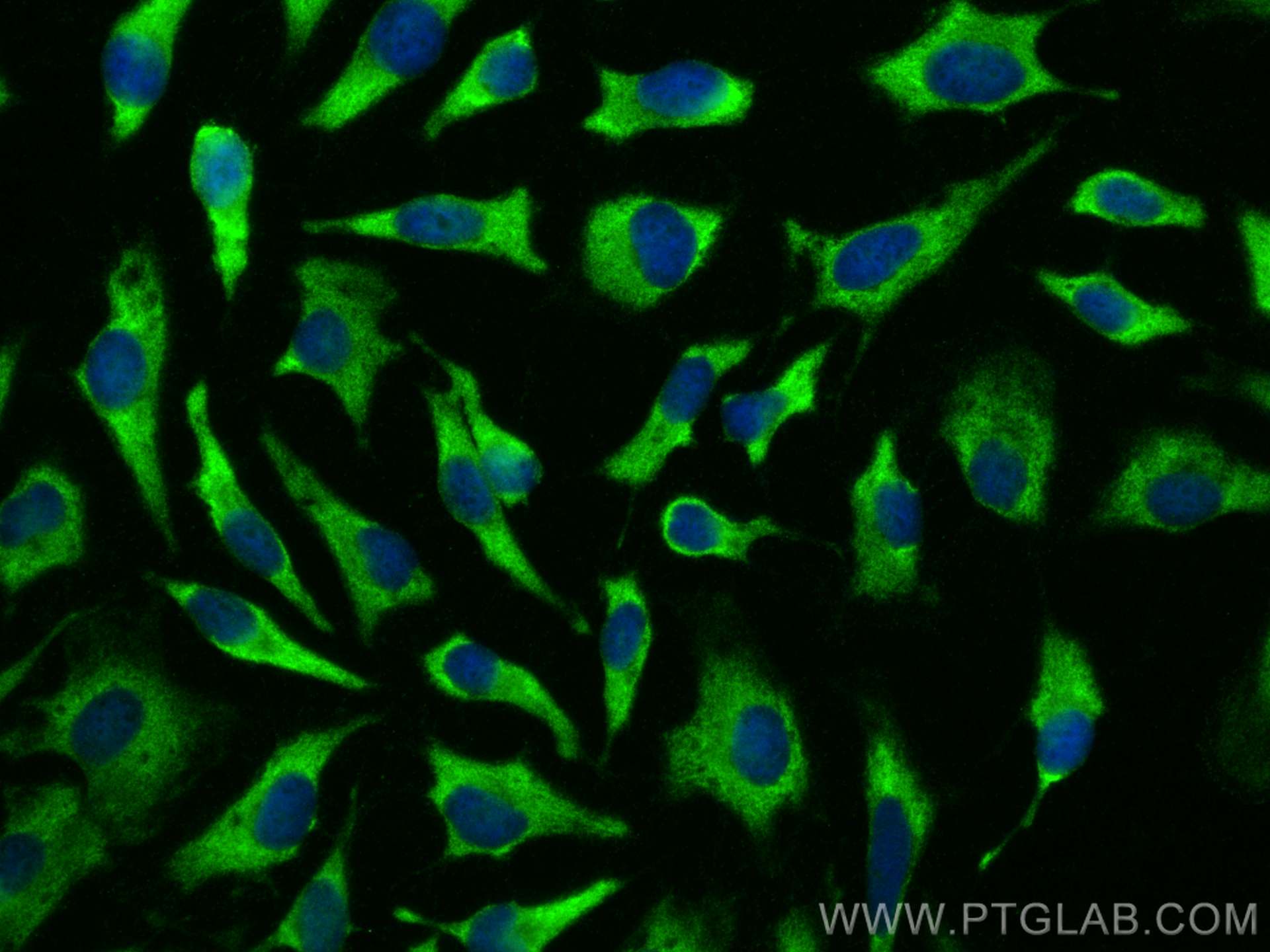 IF Staining of HeLa using 55150-1-AP