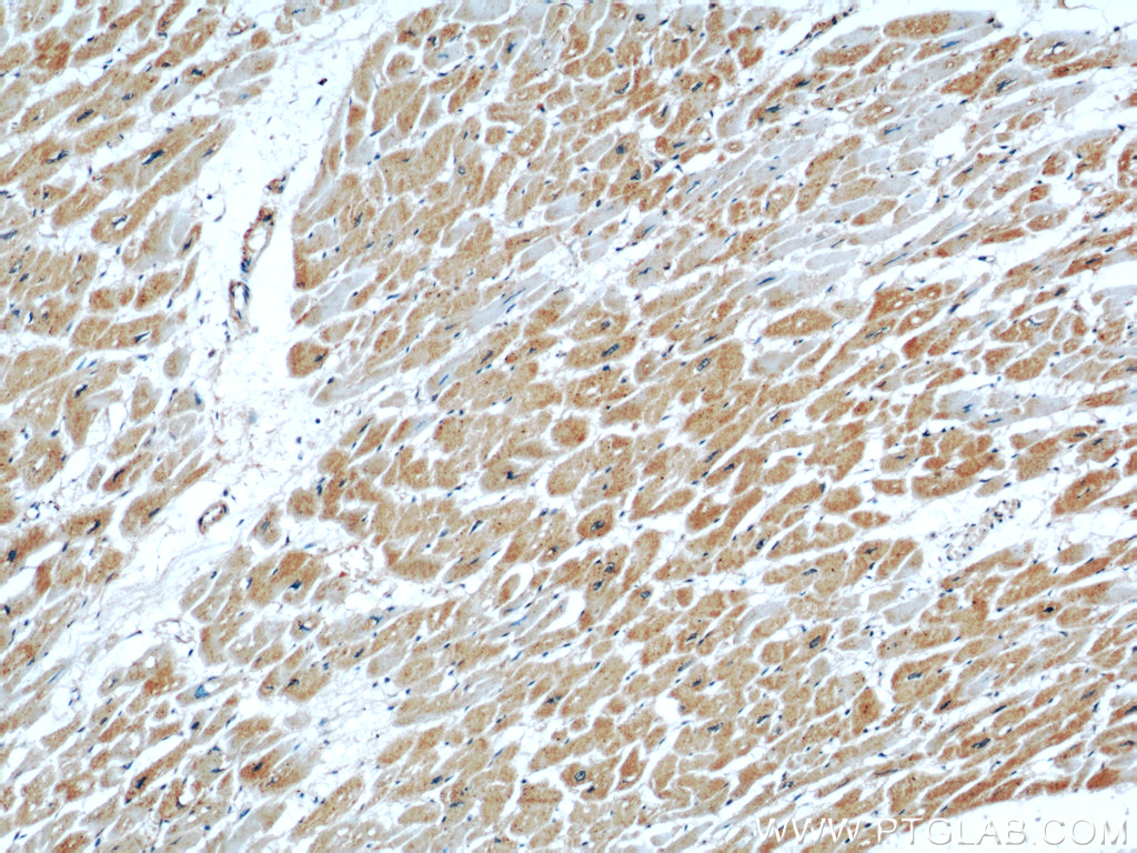 IHC staining of human heart using 55150-1-AP