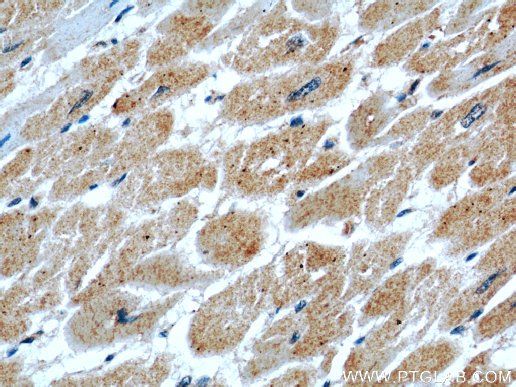 IHC staining of human heart using 55150-1-AP